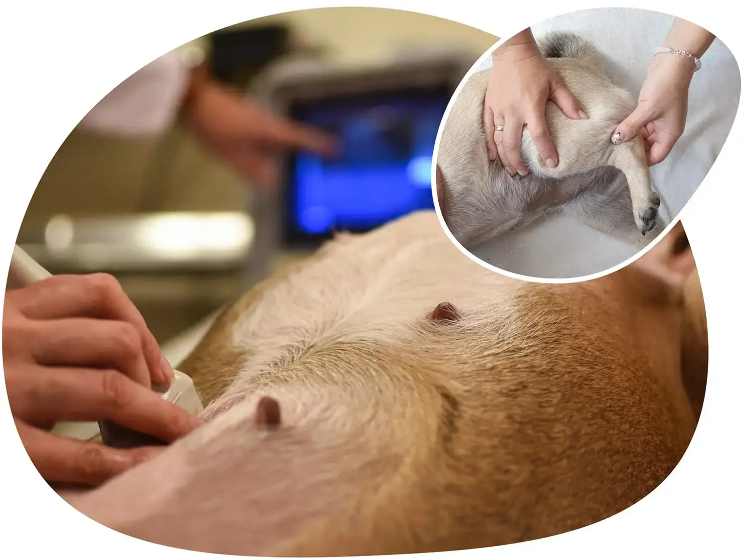 echography